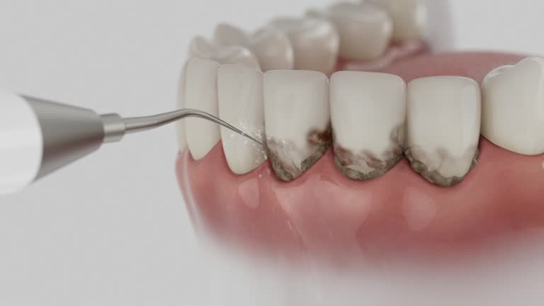 Trusted Dental Implants service in Avalon, CA - Dentist Open Now